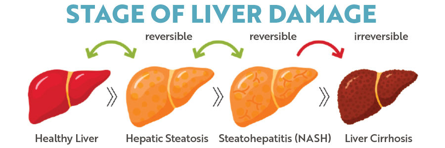 Stage of live damage